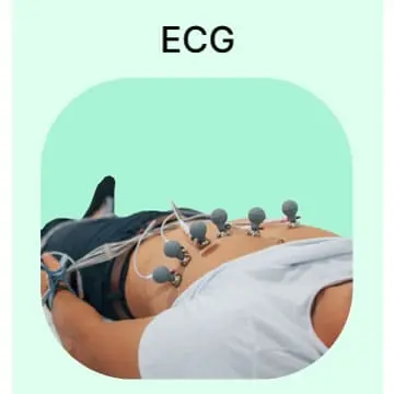 Explore in Detail About ECG