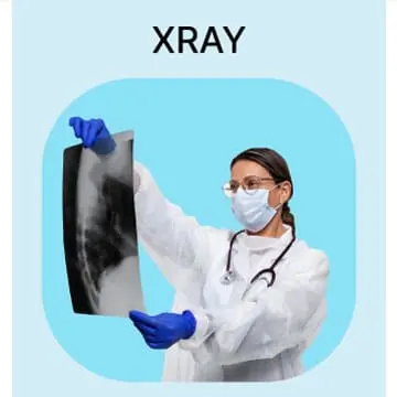 Explore in Detail About Xray